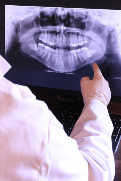 Best Emergency Wisdom Tooth Extraction in Junction City, CA