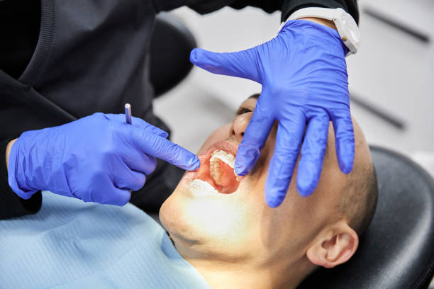 Best Broken or Chipped Tooth Repair in Junction City, CA