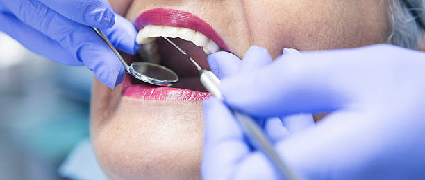 Best Emergency Care for Gum Disease in Junction City, CA